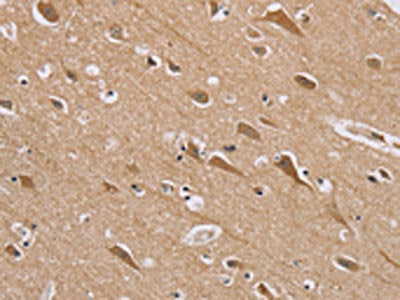 The image on the left is immunohistochemistry of paraffin-embedded Human brain tissue using CSB-PA072897(RAB6C Antibody) at dilution 1/45, on the right is treated with synthetic peptide. (Original magnification: ×200)