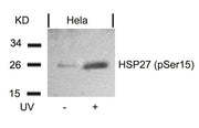 Western blot analysis of extracts from Hela cells untreated or treated with UV using HSP27(Phospho-Ser15) Antibody.