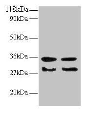 Western blot All lanes: TGFA antibody at 2µg/ml Lane 1: EC109 whole cell lysate Lane 2: 293T whole cell lysate Secondary Goat polyclonal to rabbit IgG at 1/15000 dilution Predicted band size: 18, 17 kDa Observed band size: 30, 35 kDa