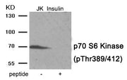 Western blot analysis of extracts from Jurkat cells treated with Insulin using Phospho-p70 S6 Kinase (Thr389/412) antibody.The lane on the right is treated with the antigen-specific peptide.