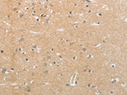 The image on the left is immunohistochemistry of paraffin-embedded Human brain tissue using CSB-PA073153(NFASC Antibody) at dilution 1/30, on the right is treated with synthetic peptide. (Original magnification: ×200)