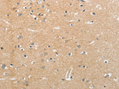 The image on the left is immunohistochemistry of paraffin-embedded Human brain tissue using CSB-PA073153(NFASC Antibody) at dilution 1/30, on the right is treated with synthetic peptide. (Original magnification: ×200)