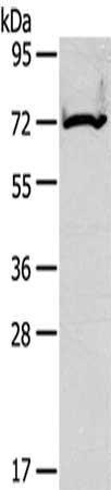 Gel: 6%SDS-PAGE,Lysate: 40 ug,,Primary antibody: CSB-PA073267(CPT2 Antibody) at dilution 1/200 dilution,Secondary antibody: Goat anti rabbit IgG at 1/8000 dilution,Exposure time: 15 seconds