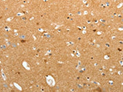 The image on the left is immunohistochemistry of paraffin-embedded Human brain tissue using CSB-PA073278(TNR Antibody) at dilution 1/60, on the right is treated with synthetic peptide. (Original magnification: ×200)