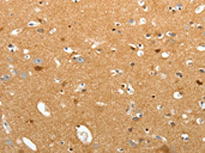 The image on the left is immunohistochemistry of paraffin-embedded Human brain tissue using CSB-PA073278(TNR Antibody) at dilution 1/60, on the right is treated with synthetic peptide. (Original magnification: ×200)