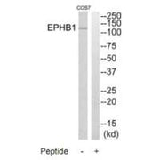 Western blot analysis of extracts from COS7 cells, using EPHB1 antibody.