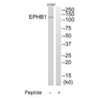 Western blot analysis of extracts from COS7 cells, using EPHB1 antibody.