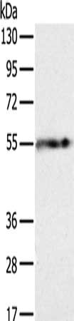 Gel: 8%SDS-PAGE, Lysate: 40 ug, Lane: Human fat tissue, Primary antibody: CSB-PA073725(PLIN1 Antibody) at dilution 1/250, Secondary antibody: Goat anti rabbit IgG at 1/8000 dilution, Exposure time: 1 minute