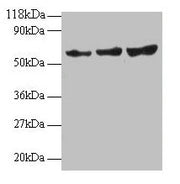 Western blot All lanes: TIMP2 antibody at 2µg/ml Lane 1: EC109 whole cell lysate Lane 2: 293T whole cell lysate Secondary Goat polyclonal to rabbit IgG at 1/15000 dilution Predicted band size: 25 kDa Observed band size: 60 kDa