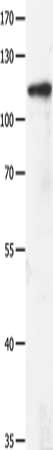 Gel: 8%SDS-PAGE, Lysate: 40 ug, Lane: 293T cells, Primary antibody: CSB-PA074225(GRM3 Antibody) at dilution 1/400, Secondary antibody: Goat anti rabbit IgG at 1/8000 dilution, Exposure time: 2 minutes