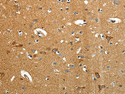 The image on the left is immunohistochemistry of paraffin-embedded Human brain tissue using CSB-PA074259(AMD1 Antibody) at dilution 1/40, on the right is treated with synthetic peptide. (Original magnification: ×200)