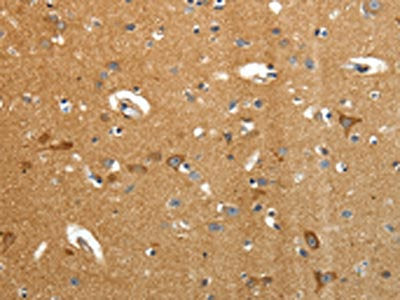 The image on the left is immunohistochemistry of paraffin-embedded Human brain tissue using CSB-PA074259(AMD1 Antibody) at dilution 1/40, on the right is treated with synthetic peptide. (Original magnification: ×200)