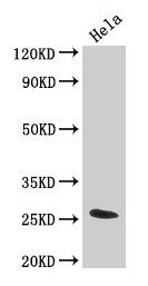 Western Blot Positive WB detected in: Hela whole cell lysate All lanes: TNF antibody at 3.2µg/ml Secondary Goat polyclonal to rabbit IgG at 1/50000 dilution Predicted band size: 26 kDa Observed band size: 26 kDa