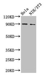 Western Blot Positive WB detected in: Hela whole cell lysate, NIH/3T3 whole cell lysate All lanes: L1CAM antibody at 2µg/ml Secondary Goat polyclonal to rabbit IgG at 1/50000 dilution Predicted band size: 141, 140, 139 kDa Observed band size: 90 kDa