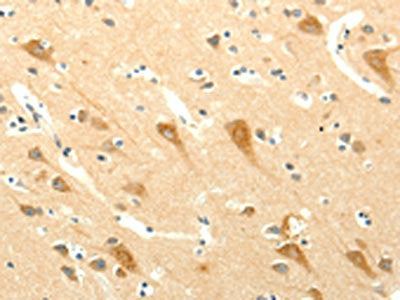The image on the left is immunohistochemistry of paraffin-embedded Human brain tissue using CSB-PA074430(SYT5 Antibody) at dilution 1/15, on the right is treated with fusion protein. (Original magnification: ×200)