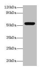 Western blot All lanes: MMP3 antibody at 2µg/ml + Mouse liver tissue Secondary Goat polyclonal to rabbit lgG at 1/15000 dilution Predicted band size: 54 kDa Observed band size: 54 kDa