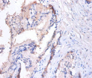 Immunohistochemistry of paraffin-embedded human prostate tissue using CSB-PA007455A0Rb at dilution of 1:100