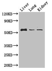Western Blot Positive WB detected in: Mouse liver tissue, Mouse lung tissue, Mouse kidney tissue All lanes: MMP8 antibody at 3ug/ml Secondary Goat polyclonal to rabbit IgG at 1/50000 dilution Predicted band size: 54 kDa Observed band size: 54 kDa
