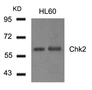Western blot analysis of extract from HL60 cells using Chk2(Ab-516) Antibody.