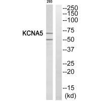 Western blot analysis of extracts from 293 cells, using KCNA5 antibody.