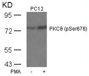 Western blot analysis of extracts from PC12 cells untreated or treated with PMA using PKCth(Phospho-Ser676) Antibody.