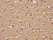 IHC image of CSB-PA07505A0Rb diluted at 1:200 and staining in paraffin-embedded human brain tissue performed on a Leica BondTM system. After dewaxing and hydration, antigen retrieval was mediated by high pressure in a citrate buffer (pH 6.0). Sect...