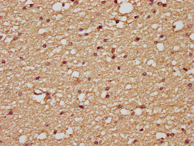 IHC image of CSB-PA07505A0Rb diluted at 1:200 and staining in paraffin-embedded human brain tissue performed on a Leica BondTM system. After dewaxing and hydration, antigen retrieval was mediated by high pressure in a citrate buffer (pH 6.0). Sect...