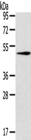 Gel: 8%SDS-PAGE, Lysate: 40 ug, Lane: Raji cells, Primary antibody: CSB-PA075110(RCC1 Antibody) at dilution 1/200, Secondary antibody: Goat anti rabbit IgG at 1/8000 dilution, Exposure time: 30 seconds