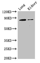 Western Blot Positive WB detected in: Mouse lung tissue, Mouse kidney tissue All lanes: CDH5 antibody at 3ug/ml Secondary Goat polyclonal to rabbit IgG at 1/50000 dilution Predicted band size: 88, 75 kDa Observed band size: 88 kDa