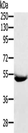 Gel: 8%SDS-PAGE, Lysate: 40 ug, Lane: Human plasma tissue, Primary antibody: CSB-PA075404(SERPING1 Antibody) at dilution 1/200, Secondary antibody: Goat anti rabbit IgG at 1/8000 dilution, Exposure time: 10 minutes