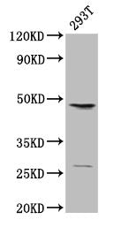 Western Blot Positive WB detected in: 293T whole cell lysate All lanes: VEGFC antibody at 2µg/ml Secondary Goat polyclonal to rabbit IgG at 1/15000 dilution Predicted band size: 47 kDa Observed band size: 47 kDa