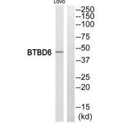 Western blot analysis of extracts from LOVO cells, using BTBD6 antiobdy.