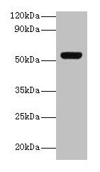 Western blot All lanes: GC antibody at 2µg/ml + A549 whole cell lysate Secondary Goat polyclonal to rabbit IgG at 1/10000 dilution Predicted band size: 53, 40, 56 kDa Observed band size: 53 kDa