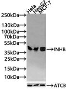 Western blot All lanes: INHBA antibody at 2µg/ml Lane 1: Hela whole cell lysate Lane 2: HepG2 whole cell lysate Lane 3: A549 whole cell lysate Lane 4: MCF-7 whole cell lysate Secondary Goat polyclonal to rabbit IgG at 1/10000 dilution Predicted ba...