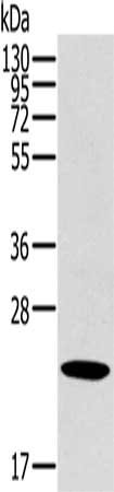 Gel: 10%SDS-PAGE, Lysate: 40 ug, Lane: Human liver cancer tissue, Primary antibody: CSB-PA076030(OTUB2 Antibody) at dilution 1/800, Secondary antibody: Goat anti rabbit IgG at 1/8000 dilution, Exposure time: 30 seconds