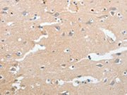 The image on the left is immunohistochemistry of paraffin-embedded Human brain tissue using CSB-PA076130(LCN2 Antibody) at dilution 1/50, on the right is treated with synthetic peptide. (Original magnification: ×200)