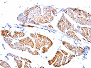 The image on the left is immunohistochemistry of paraffin-embedded Human urinary bladder tissue using CSB-PA076198(CASP2 Antibody) at dilution 1/100, on the right is treated with fusion protein. (Original magnification: ×200)