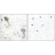 Immunohistochemical analysis of paraffin-embedded human brain tissue using Parkin antibody.