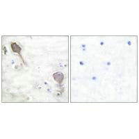Immunohistochemical analysis of paraffin-embedded human brain tissue using Parkin antibody.