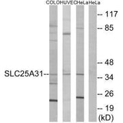Western blot analysis of extracts from COLO cells, HUVEC cells and HeLa cells, using SLC25A31 antibody.