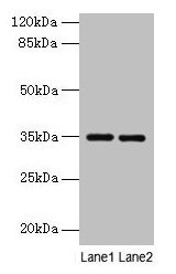 Western blot All lanes: Thpo antibody at 4µg/ml Lane 1: Mouse liver tissue Lane 2: 293T whole cell lysate Secondary Goat polyclonal to rabbit IgG at 1/10000 dilution Predicted band size: 35 kDa Observed band size: 35 kDa
