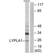Western blot analysis of extracts from COLO cells, using LYPLA1 antibody.