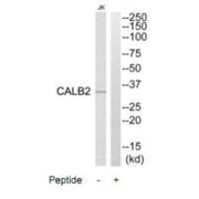 Western blot analysis of extracts from Jurkat cells, using CALB2 antibody.