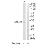 Western blot analysis of extracts from Jurkat cells, using CALB2 antibody.