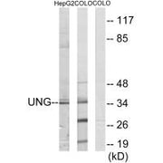 Western blot analysis of extracts from HepG2 cells and COLO cells, using UNG antibody.
