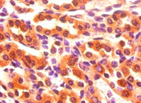 Immunohistochemistry of paraffin-embedded mouse kidney tissue using CSB-PA07764A0Rb at dilution of 1:50