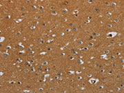 The image on the left is immunohistochemistry of paraffin-embedded Human brain tissue using CSB-PA077659(CSH1 Antibody) at dilution 1/40, on the right is treated with fusion protein. (Original magnification: ×200)
