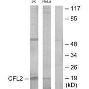 Western blot analysis of extracts from Jurkat cells and HeLa cells, using Cofilin antibody.