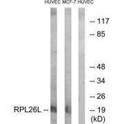 Western blot analysis of extracts from HUVEC cells and MCF-7 cells, using RPL26L antibody.