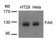 Western blot analysis of extracts from HT29 and Hela cells using FAK(Ab-576/577) Antibody.